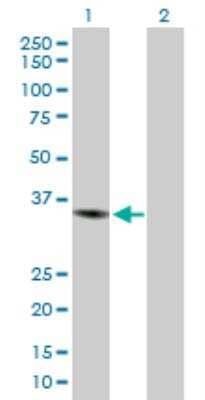Western Blot: CHI3L1 Antibody [H00001116-D01P] - analysis of CHI3L1 expression in transfected 293T cell line by CHI3L1 MaxPab rabbit polyclonal antibody. Lane 1: CHI3L1 transfected lysate (42.60 KDa). Lane 2: Non-transfected lysate.