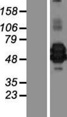 Western Blot: CHI3L2 Overexpression Lysate (Adult Normal) [NBP2-08651] Left-Empty vector transfected control cell lysate (HEK293 cell lysate); Right -Over-expression Lysate for CHI3L2.