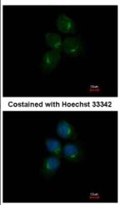 Immunocytochemistry/Immunofluorescence: AMCase/CHIA Antibody [NBP2-15880] - Analysis of methanol-fixed A431, using antibody at 1:500 dilution.