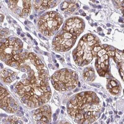 Immunohistochemistry: AMCase/CHIA Antibody [NBP2-32440] -  Staining of stomach.