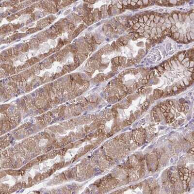 Immunohistochemistry: AMCase/CHIA Antibody [NBP2-32440] -  Staining of human stomach, upper shows moderate cytoplasmic positivity in glandular cells.