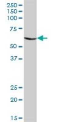 Western Blot: CHIA Antibody [H00027159-B01P] - Analysis of CHIA expression in human liver.