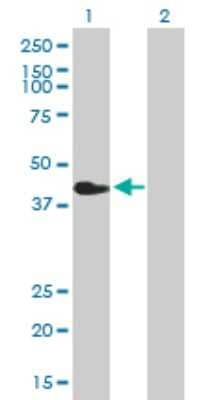 Western Blot: CHIA Antibody [H00027159-B01P] - Analysis of CHIA expression in transfected 293T cell line by CHIA polyclonal antibody.  Lane 1: CHIA transfected lysate(40.48 KDa). Lane 2: Non-transfected lysate.