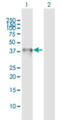 Western Blot: CHIA Antibody [H00027159-D01P] - Analysis of CHIA expression in transfected 293T cell line by CHIA polyclonal antibody.Lane 1: CHIA transfected lysate(40.10 KDa).Lane 2: Non-transfected lysate.