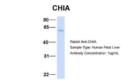 Western Blot: AMCase/CHIA Antibody [NBP1-58987] -  Human Fetal Liver, Antibody Dilution: 1.0 ug/ml.