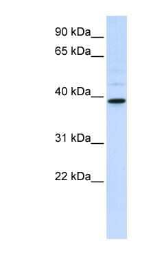 Western Blot: AMCase/CHIA Antibody [NBP1-58988] -  Hela cell lysate, concentration 0.2-1 ug/ml.