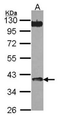 Western Blot: AMCase/CHIA Antibody [NBP2-15880] -  Sample (30 ug of whole cell lysate) A: JurKat 10% SDS PAGE gel, diluted at 1:1000.