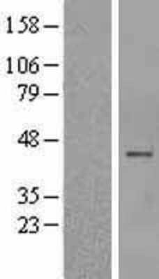 Western Blot: AMCase/CHIA Overexpression Lysate [NBL1-09153] -  Left-Empty vector transfected control cell lysate (HEK293 cell lysate); Right -Over-expression Lysate for CHIA.