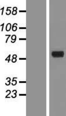 Western Blot: AMCase/CHIA Overexpression Lysate [NBP2-04604] - Left-Empty vector transfected control cell lysate (HEK293 cell lysate); Right -Over-expression Lysate for CHIA.