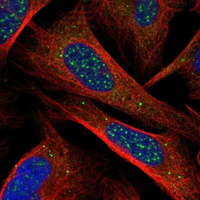 Immunocytochemistry/ Immunofluorescence CHIC1 Antibody - BSA Free