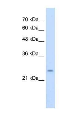 Western Blot: CHIC1 Antibody [NBP1-91589] - Titration: 5.0ug/ml Positive Control: Jurkat cell lysate.