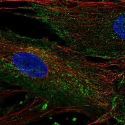 Immunocytochemistry/Immunofluorescence: CHIC2 Antibody [NBP2-68599] - Staining of human cell line BJ shows localization to plasma membrane & vesicles.