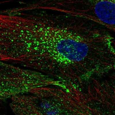 Immunocytochemistry/Immunofluorescence: CHIC2 Antibody [NBP2-69022] - Staining of human cell line BJ shows localization to plasma membrane & vesicles.