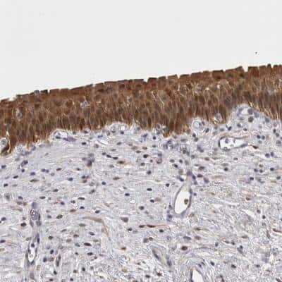 Immunohistochemistry: CHIC2 Antibody [NBP1-88513] - Staining of human urinary bladder shows distinct cytoplasmic positivity in urothelial cells.