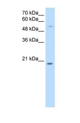 Western Blot: CHIC2 Antibody [NBP1-59955] - Titration: 0.25ug/ml Positive Control: HepG2 cell lysate.