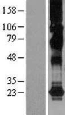 Western Blot CHIC2 Overexpression Lysate