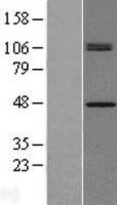 Western Blot CHID1 Overexpression Lysate