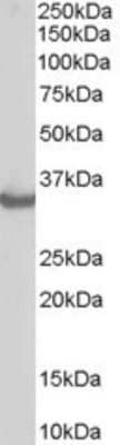 Western Blot: CHIP Antibody [NB300-982] - (0.3ug/ml) Analysis of Human Muscle lysate (RIPA buffer, 35ug total protein per lane). Primary incubated for 1 hour. Detected by western blot using chemiluminescence.