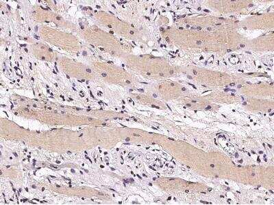 Immunohistochemistry-Paraffin: CHIP/STUB1 Antibody (006) [NBP2-90115] - Immunochemical staining of human STUB1 in human skeletal muscle with rabbit monoclonal antibody (1:200, formalin-fixed paraffin embedded sections).