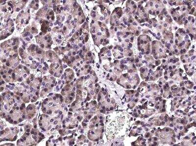 Immunohistochemistry-Paraffin: CHIP/STUB1 Antibody (006) [NBP2-90115] - Immunochemical staining of human STUB1 in human pancreas with rabbit monoclonal antibody (1:200, formalin-fixed paraffin embedded sections).