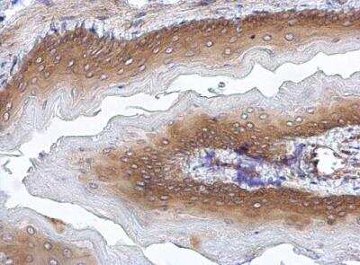 Immunohistochemistry-Paraffin: CHIP/STUB1 Antibody [NBP1-30936] - Paraffin-embedded mouse esophagus. STUB1 antibody [C1C3] diluted at 1:500.