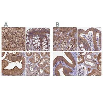 Immunohistochemistry-Paraffin: CHIP/STUB1 Antibody [NBP2-47509] - Staining of human adrenal gland, colon, gallbladder and kidney using Anti-STUB1 antibody NBP2-47509 (A) shows similar protein distribution across tissues to independent antibody NBP2-47510 (B).