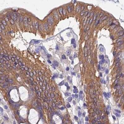 Immunohistochemistry-Paraffin: CHIP/STUB1 Antibody [NBP2-47510] - Staining of human colon.