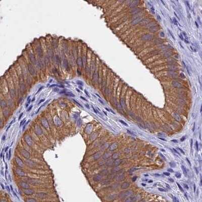 Immunohistochemistry-Paraffin: CHIP/STUB1 Antibody [NBP2-47510] - Staining of human gallbladder.