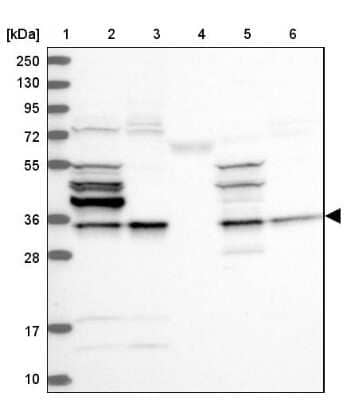 <b>Independent Antibodies Validation. </b>Western Blot: CHIP/STUB1 Antibody [NBP2-47510] - Lane 1: Marker  [kDa] 250, 130, 95, 72, 55, 36, 28, 17, 10.  Lane 2: Human cell line RT-4.  Lane 3: Human cell line U-251MG.  Lane 4: Human plasma (IgG/HSA depleted).  Lane 5: Human Analysis of  tonsil tissue.