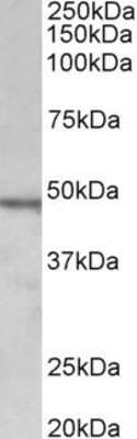 Western Blot: CHIT1 Antibody [NBP1-97774] - (1ug/ml) Analysis of Daudi lysate (35ug protein in RIPA buffer). Primary incubation was 1 hour. Detected by chemiluminescence.