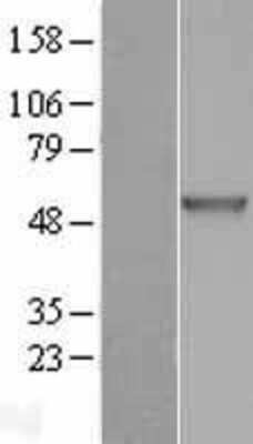 Western Blot: CHIT1 Overexpression Lysate (Adult Normal) [NBL1-09156] Left-Empty vector transfected control cell lysate (HEK293 cell lysate); Right -Over-expression Lysate for CHIT1.