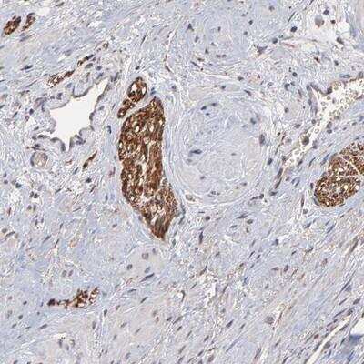 Immunohistochemistry: CHL-1/L1CAM-2 Antibody [NBP1-86660] - Staining of human prostate shows strong positivity in peripheral nerves.