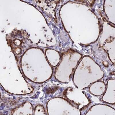 Immunohistochemistry-Paraffin: CHMP2A Antibody [NBP1-91781] - Staining of human thyroid gland shows high expression.