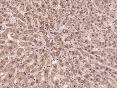 Immunohistochemistry-Paraffin: CHMP2A Antibody [NBP2-97282] - Immunochemical staining of human CHMP2A in human liver with rabbit polyclonal antibody at 1:100 dilution, formalin-fixed paraffin embedded sections.