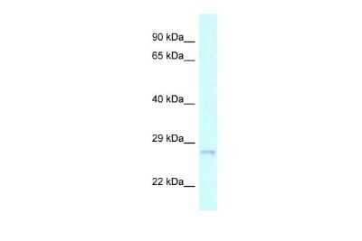 Western Blot: CHMP2A Antibody [NBP2-87182] - WB Suggested Anti-CHMP2A Antibody. Titration: 1.0 ug/ml. Positive Control: 293T Whole Cell