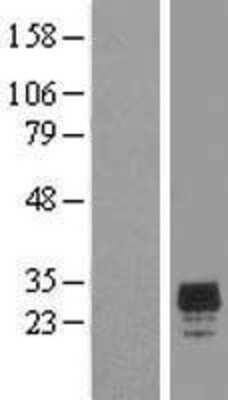 Western Blot: CHMP2A Overexpression Lysate (Adult Normal) [NBL1-09159] Left-Empty vector transfected control cell lysate (HEK293 cell lysate); Right -Over-expression Lysate for CHMP2A.