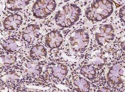 Immunohistochemistry-Paraffin: CHMP4A Antibody [NBP3-06005] - Staining of human CHMP4A in human rectum with rabbit polyclonal antibody at 1:100 dilution.