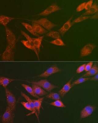 Immunocytochemistry/Immunofluorescence: CHMP4B Antibody [NBP2-92805] - Immunofluorescence analysis of NIH/3T3 cells using CHMP4B Rabbit pAb (NBP2-92805) at dilution of 1:50 (40x lens). Blue: DAPI for nuclear staining.