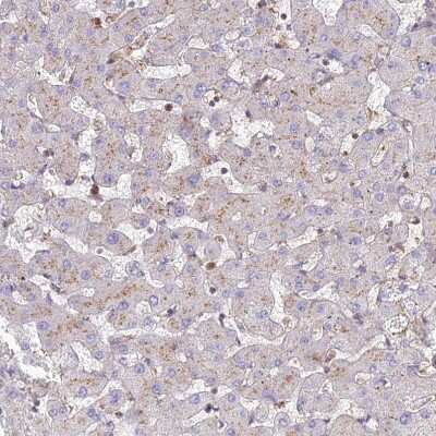 Immunohistochemistry-Paraffin: CHMP4B Antibody [NBP1-91782] - Staining of human liver shows weak granular cytoplasmic positivity in hepatocytes as expected.