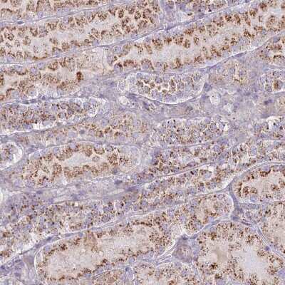 Immunohistochemistry-Paraffin: CHMP4B Antibody [NBP1-91782] - Staining of human kidney shows moderate to strong granular cytoplasmic positivity in cells in tubules.