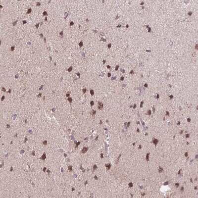 <b>Orthogonal Strategies Validation. </b>Immunohistochemistry-Paraffin: CHMP4B Antibody [NBP2-49018] - Staining of human cerebral cortex shows high expression.