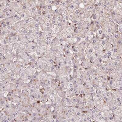 Immunohistochemistry-Paraffin: CHMP4B Antibody [NBP2-49018] - Staining of human liver shows low expression as expected.