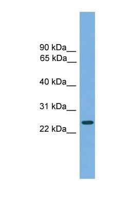 Western Blot: CHMP4B Antibody [NBP1-56995] - Jurkat cell lysate, concentration 0.2-1 ug/ml.