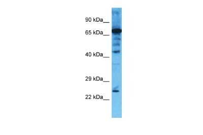 Western Blot: CHMP4B Antibody [NBP1-56995] - Jurkat Whole Cell lysates, Antibody Dilution: 1.0 ug/ml.