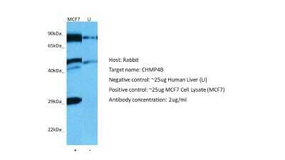 Western Blot: CHMP4B Antibody [NBP2-87183] - Host: Rabbit. Target: CHMP4B. Positive control (+): MCF7 (N10). Negative control (-): Human liver (LI). Antibody concentration: 1ug/ml