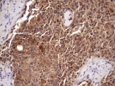 Immunohistochemistry: CHMP5 Antibody (5C7) [NBP2-46283] - Analysis of Human thyroid tissue. (Heat-induced epitope retrieval by Tris-EDTA, pH8.0)