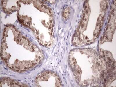 Immunohistochemistry: CHMP5 Antibody (5C7) [NBP2-46283] - Analysis of Human prostate tissue. (Heat-induced epitope retrieval by Tris-EDTA, pH8.0)