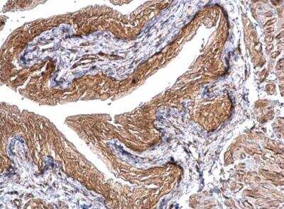 Immunohistochemistry-Paraffin: CHMP5 Antibody [NBP1-32597] -  Mouse urinary bladder. CHMP5 stained by CHMP5 antibody [N1C3] diluted at 1:500. Antigen Retrieval: Trilogy™ (EDTA based, pH 8.0) buffer, 15min.