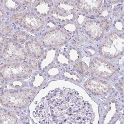Immunohistochemistry-Paraffin: CHMP5 Antibody [NBP2-48776] - Staining of human kidney shows cytoplasmic positivity in renal tubules.