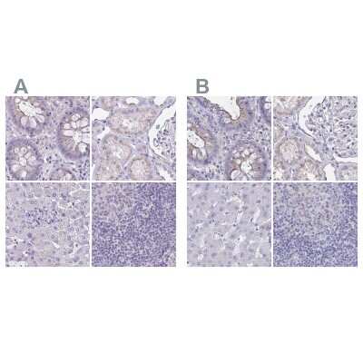 <b>Independent Antibodies Validation. </b>Immunohistochemistry-Paraffin: CHMP5 Antibody [NBP2-48776] - Staining of human colon, kidney, liver and lymph node using Anti-CHMP5 antibody NBP2-48776 (A) shows similar protein distribution across tissues to independent antibody NBP2-49227 (B).